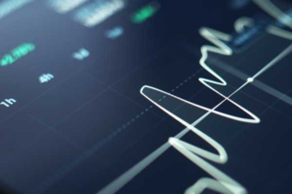 黄仁勋表示 美国的芯片限制使英伟达在中国的市场份额减少了近一半